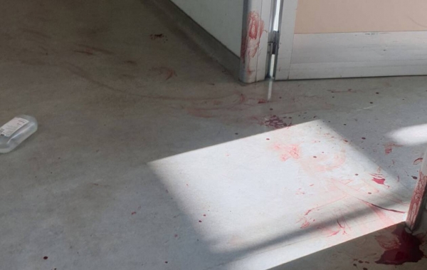 Εικόνες φρίκης στο «Αττικόν»: Έτσι μαχαίρωσε ο 59χρονος τη νοσηλεύτρια πριν βάλει τέλος στη ζωή του
